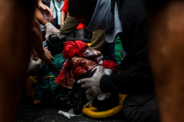 Impactante: Pablo Grillo, fotógrafo herido en la marcha de jubilados
