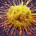 Descubre la Impactante Creencia Argentina sobre la Cura del Cáncer