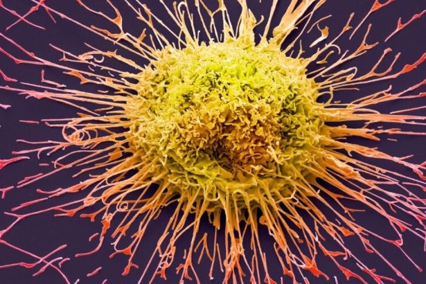 Descubre la Impactante Creencia Argentina sobre la Cura del Cáncer