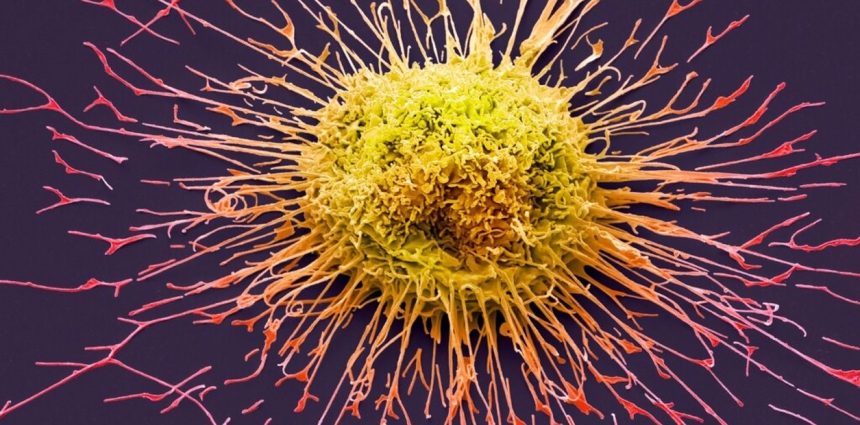 Descubre la Impactante Creencia Argentina sobre la Cura del Cáncer