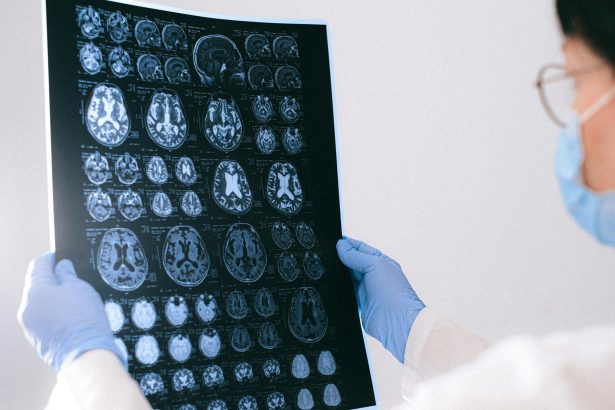 Descubren dos vacunas que podrían combatir el Alzheimer: ¡Increíble!