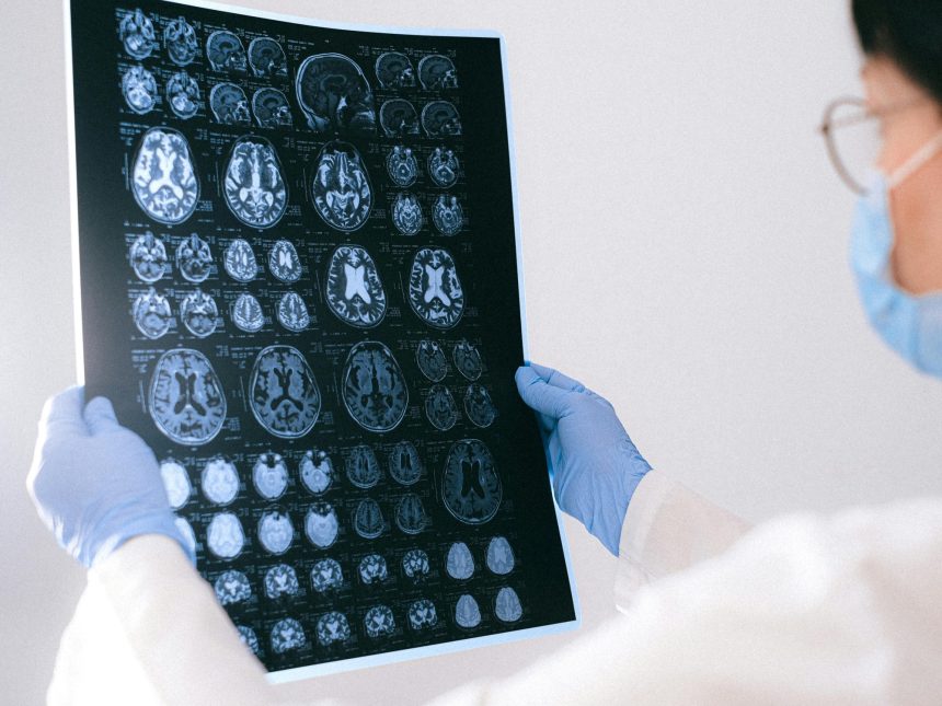 Descubren dos vacunas que podrían combatir el Alzheimer: ¡Increíble!