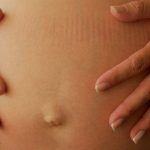 Un País Hace Historia: Elimina VIH, Sífilis y Hepatitis B en Madres