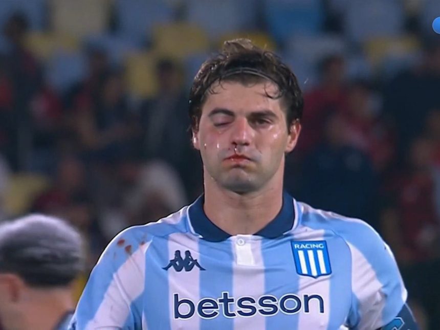 Santiago Sosa se pierde la revancha ante Flamengo por lesión