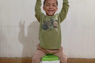 Acondroplasia: Cómo enfrentar el enanismo y sus tratamientos efectivos