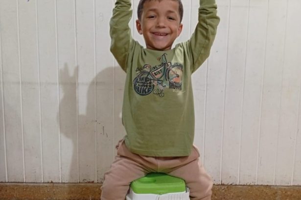 Acondroplasia: Cómo enfrentar el enanismo y sus tratamientos efectivos