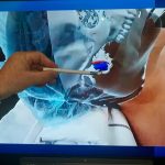 Descubre la cirugía del futuro: Realidad aumentada en Coghlan