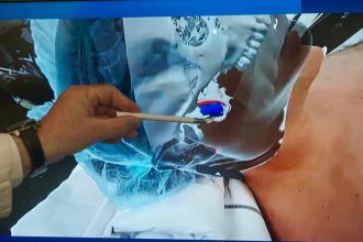 Descubre la cirugía del futuro: Realidad aumentada en Coghlan