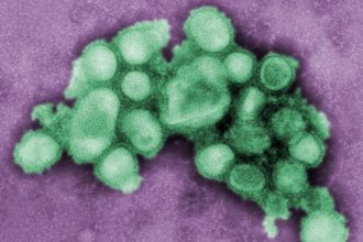 ¡Alerta! La gripe H3N2 se acerca a Argentina: Vacúnate ya