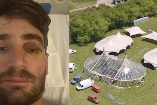 Celebró Año Nuevo en Patagonia y perdió un ojo por un petardo