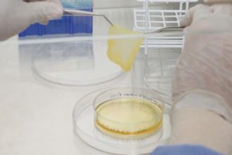 Argentina Innova en Recuperación de Piel Tras Quemaduras: ¡Descubre Cómo!