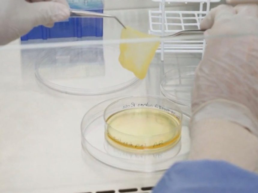 Argentina Innova en Recuperación de Piel Tras Quemaduras: ¡Descubre Cómo!