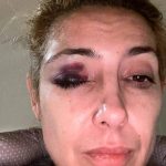 Alberto Fernández intenta frenar causa de violencia con pericia psiquiátrica a Fabiola Yañez