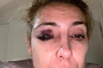 Alberto Fernández intenta frenar causa de violencia con pericia psiquiátrica a Fabiola Yañez