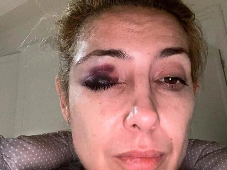 Alberto Fernández intenta frenar causa de violencia con pericia psiquiátrica a Fabiola Yañez