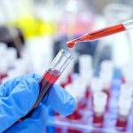 Revolución en la cura del VIH: Trasplante de células madre exitoso