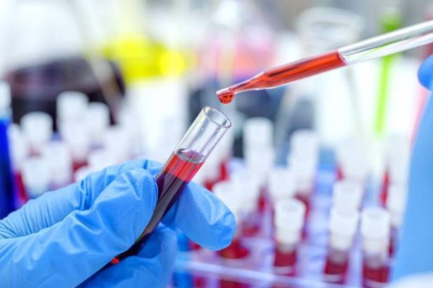 Revolución en la cura del VIH: Trasplante de células madre exitoso