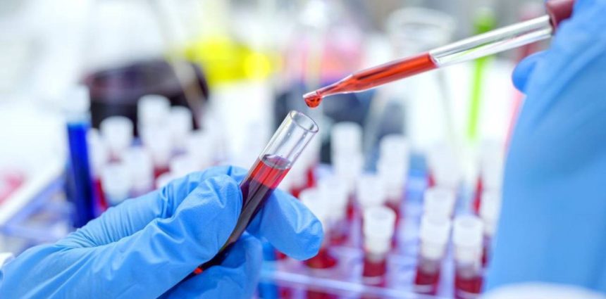 Revolución en la cura del VIH: Trasplante de células madre exitoso