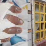 Tragedia escolar: Niño con 95% de la mano destruida por ventana caída