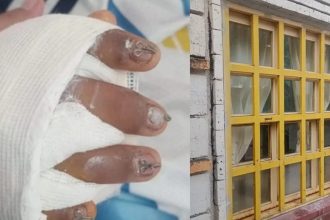 Tragedia escolar: Niño con 95% de la mano destruida por ventana caída