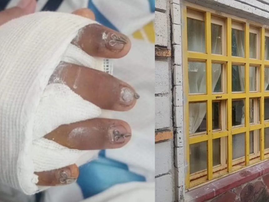 Tragedia escolar: Niño con 95% de la mano destruida por ventana caída