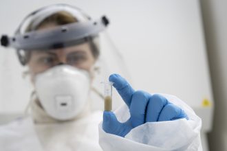 Aumento de hepatitis A y hallazgo de virus en aguas residuales