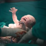 ¿Inyección epidural en partos sin dolor? Impacto en la salud del bebé