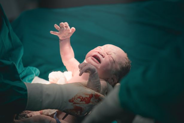¿Inyección epidural en partos sin dolor? Impacto en la salud del bebé