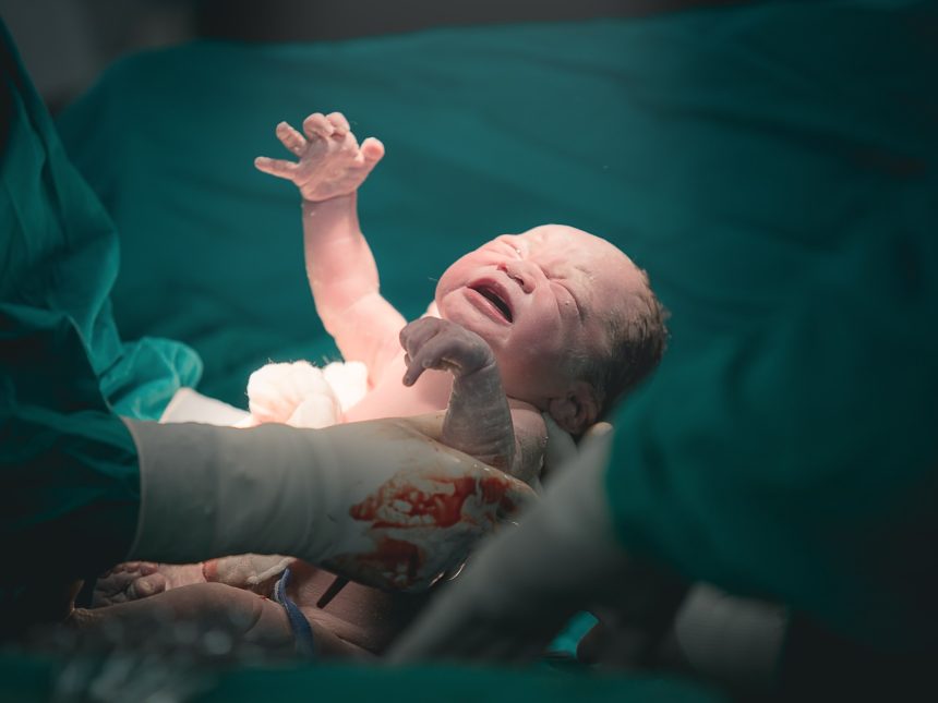 ¿Inyección epidural en partos sin dolor? Impacto en la salud del bebé